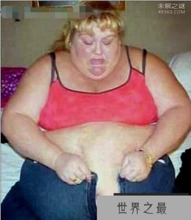 全球最胖的女人,苏珊娜·埃曼和罗莎莉·布拉德福德(两人重达253