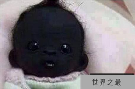 世界上最黑的男孩和世界上最白的女孩(都是真的)