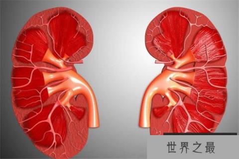 世界十大绝症 早衰基本活不过二十岁，第八高发于老人群体