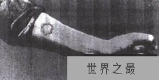 镭姑娘事件：芳华正茂受着非人的折磨