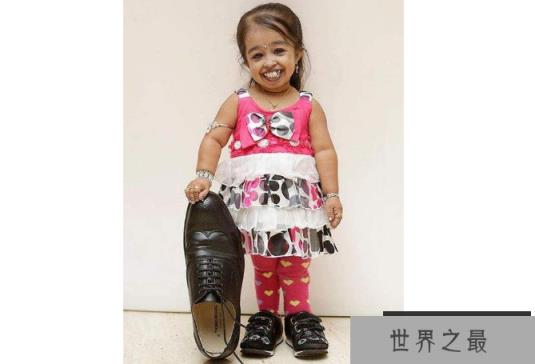 世界十大矮小人 最高只有72.4厘米,第一创下吉尼斯纪录