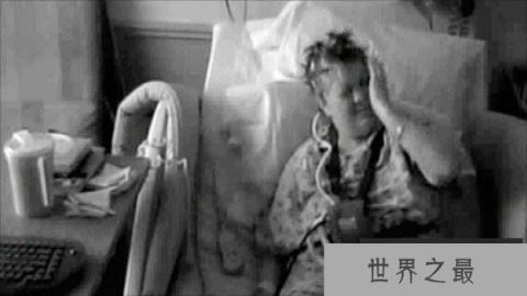 世界十大罕见病:一种变成活死人一种变成蓝血人