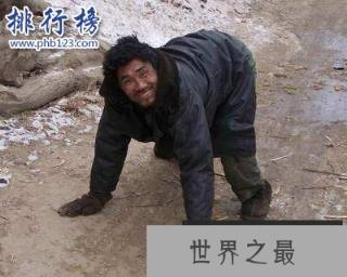 世界十大罕见病:一种变成活死人一种变成蓝血人