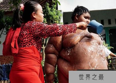 世界上最胖的孩子，印尼十岁男孩体重惊人(192公斤)
