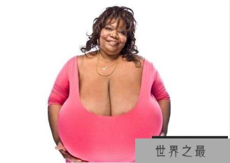 世界上最大的胸部，安妮·霍金斯特纳(胸部重达77斤)