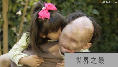 美国无脸男传说，现实存在的无脸男