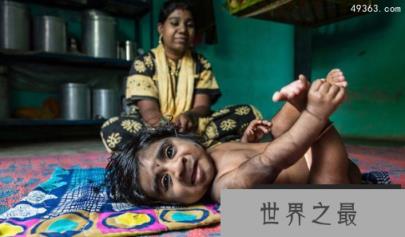 印度狼孩卡马拉，真实故事令人震惊！