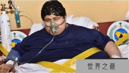 世界上最重的人排行，第一名体重1270斤(病态重)