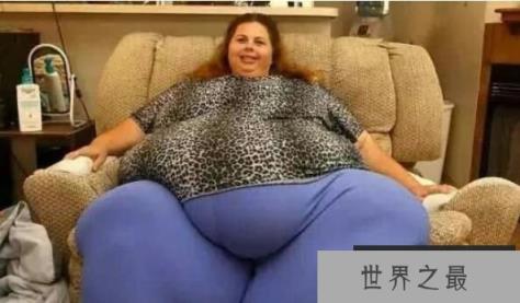 世界上最重的人排行，第一名体重1270斤(病态重)