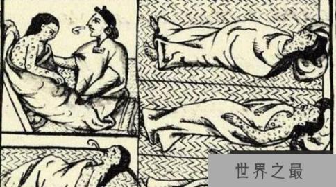 历史上最可怕的病毒：天花，曾经是人类噩梦(威力不逊黑死病)