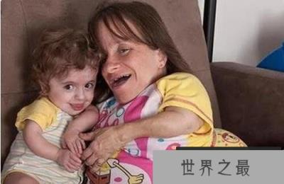 世界上最矮的妈妈：斯塔赛·赫拉尔德，净身高仅71厘米