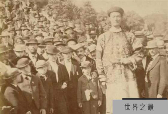 叹为观止：世界上最高的人 身高达到3.19米(无病生长)