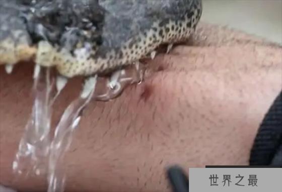 世界上最耐咬的男人 把自己的身体送给猛兽咬(Coyote)