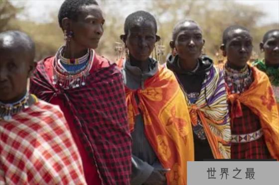 世界上视力最好的人 Ronicke Cedell(相当于千里眼)