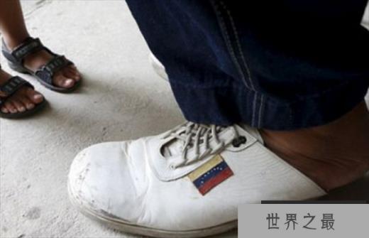 世界上最大的脚 来自委内瑞拉的男子(均40.4厘米)