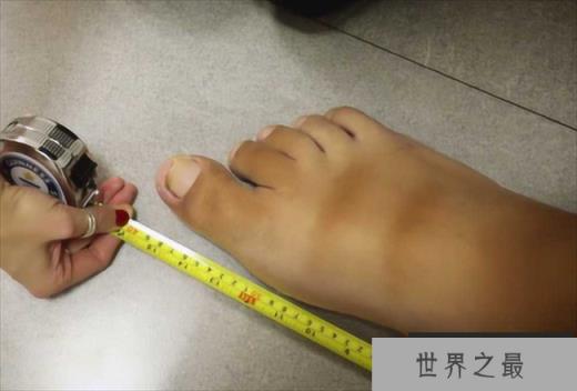世界上最大的脚 来自委内瑞拉的男子(均40.4厘米)