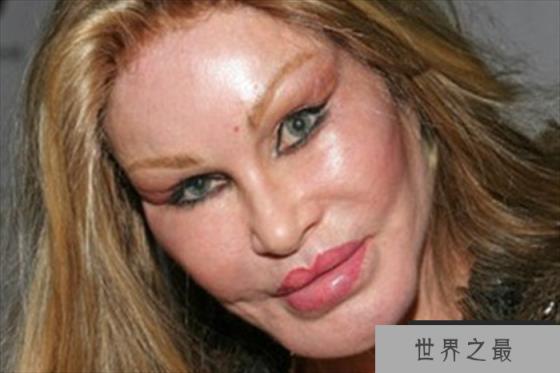 世界上整容最多的女人 整了36次还不满意(马诺什·瓦斯奎兹)