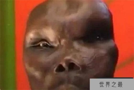 世界上最丑的男人 连娶两任老婆(生8个孩子)