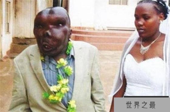 世界上最丑的男人 连娶两任老婆(生8个孩子)