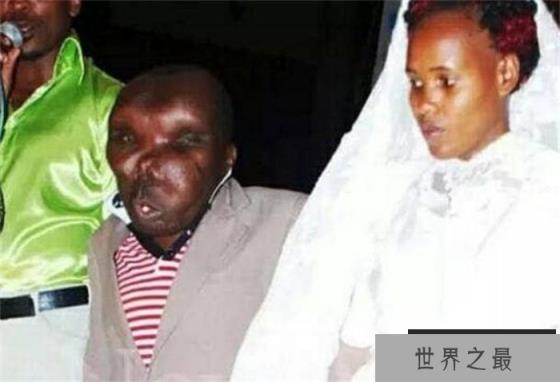世界上最丑的男人 连娶两任老婆(生8个孩子)