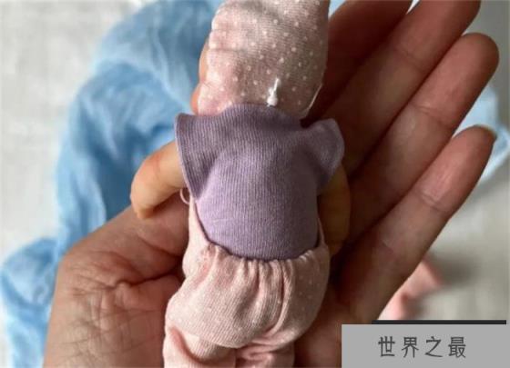 世界上最小的婴儿 五胞胎当中的孩子(250克)