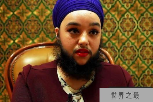 世界上胡子最长的女性 维维安胡须长25厘米(患有多毛症)