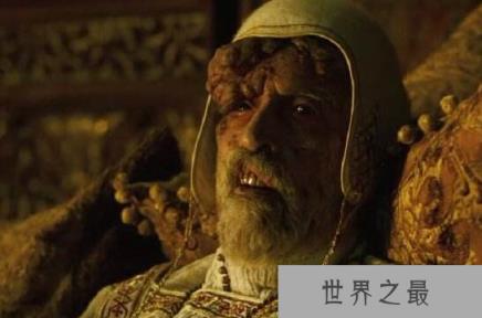 历史上三大黑死病瘟疫,屠杀犹太人上亿人遇难