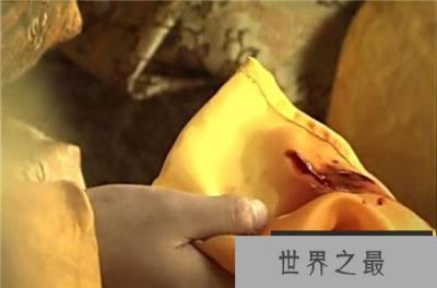 咸丰皇帝受了风寒，再加上天天在床上作”俯卧撑“，终于病倒了