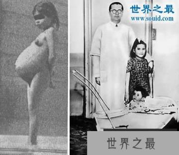 世界上最大的婴儿，出生既37斤(等同于6岁孩子体重)(www.1357vip.com)