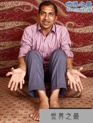 世界上最多的手指和脚趾,一共有28根(www.1357vip.com)