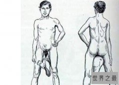 世界十大怪胎：狮面人上榜，竟存在拥有两个阴茎的男人