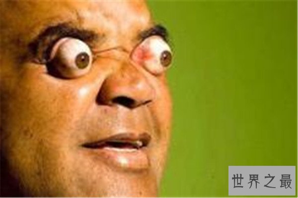 世界十大最奇异的人 打越三敬冬眠三周，第六在家中自燃