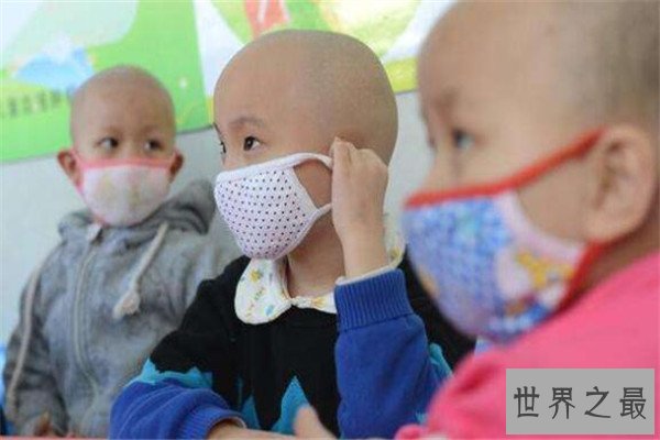 世界十大绝症 早衰基本活不过二十岁，第八高发于老人群体