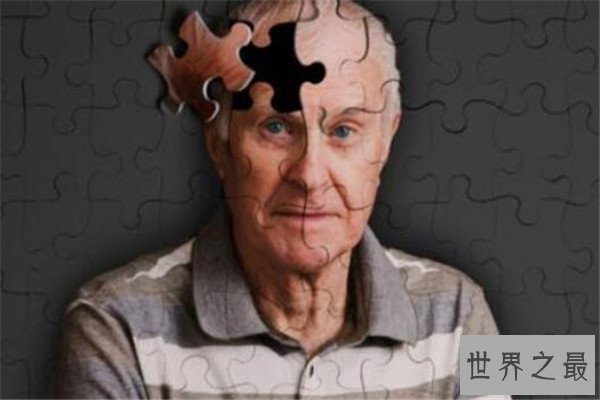 世界十大绝症 早衰基本活不过二十岁，第八高发于老人群体