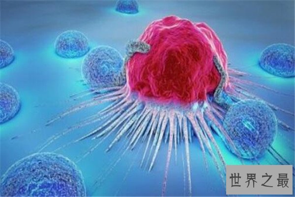 世界十大绝症 早衰基本活不过二十岁，第八高发于老人群体