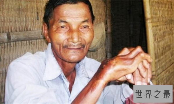 世界十大奇怪的人 男人也能怀孕，太奇葩了