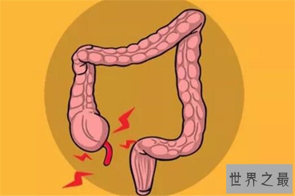 世界十大疼痛 急性阑尾炎上榜，难产疼痛指数无法估计