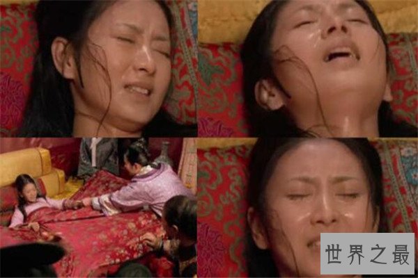 世界十大疼痛 急性阑尾炎上榜，难产疼痛指数无法估计