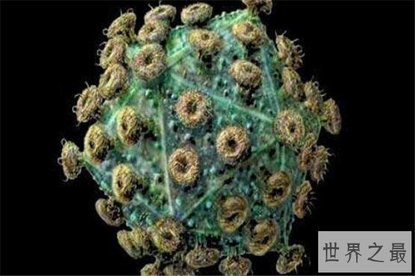 世界十大病毒 非典病毒曾引起全球恐慌，第八几乎都知道