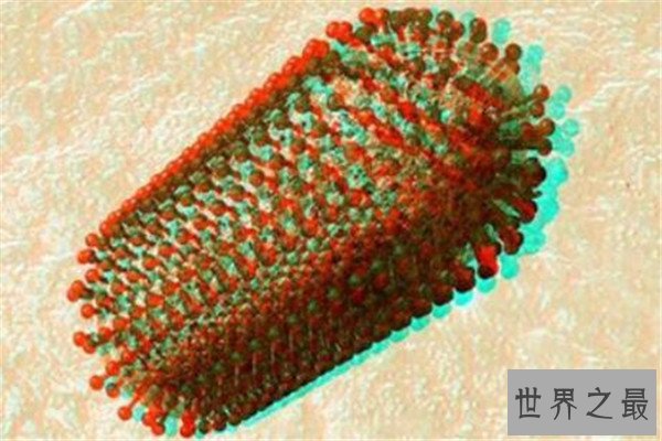 世界十大病毒 非典病毒曾引起全球恐慌，第八几乎都知道