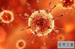 世界十大病毒 非典病毒曾引起全球恐慌，第八几乎都知道