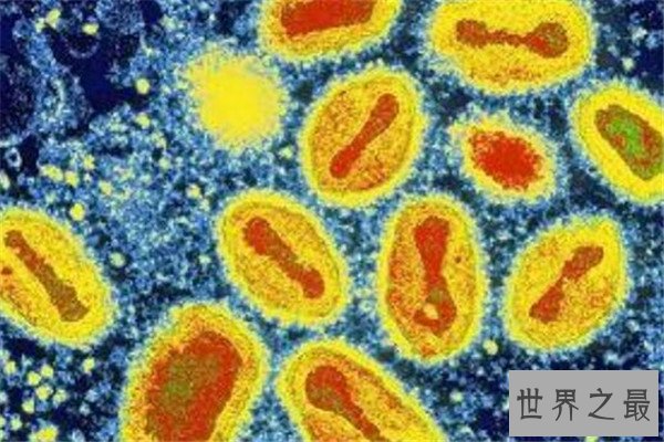 世界十大病毒 非典病毒曾引起全球恐慌，第八几乎都知道