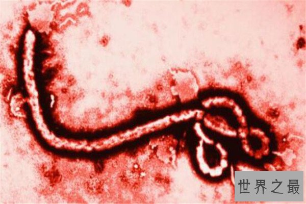 世界十大病毒 非典病毒曾引起全球恐慌，第八几乎都知道