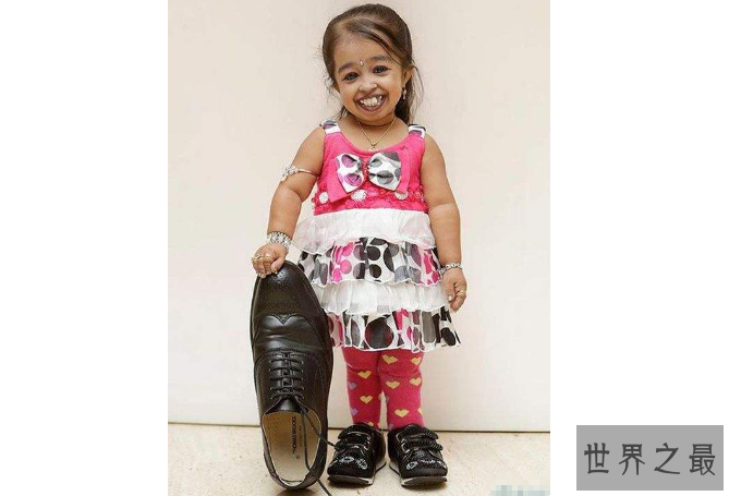 世界十大矮小人 最高只有72.4厘米，第一创下吉尼斯纪录