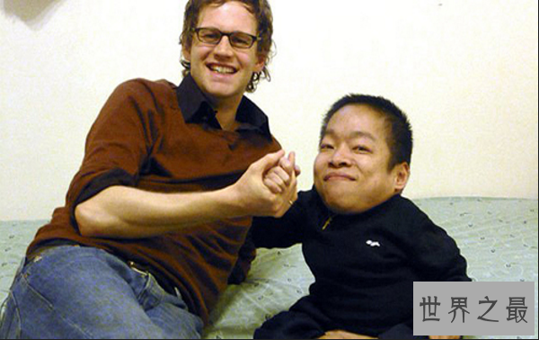 世界十大矮小人 最高只有72.4厘米，第一创下吉尼斯纪录