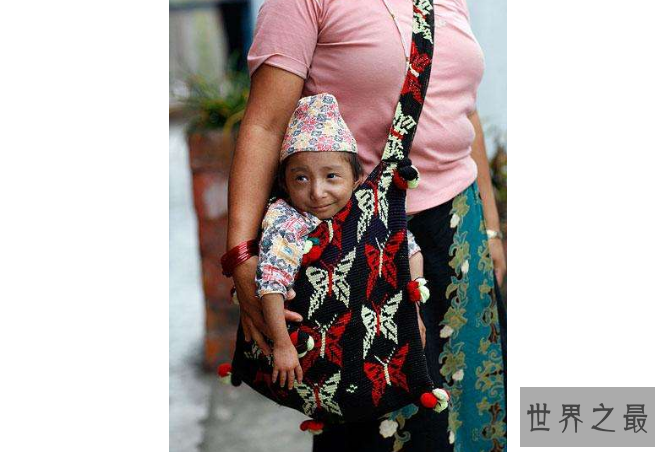 世界十大矮小人 最高只有72.4厘米，第一创下吉尼斯纪录