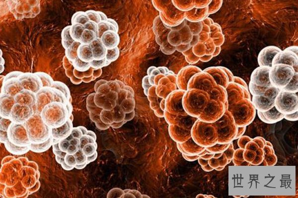 全球十大病毒排行榜