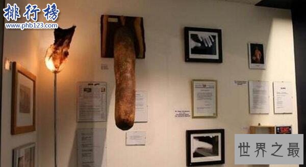 世界上最长的阴茎：战斗状态下60厘米，东北吴先生为国争光