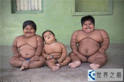 世界上体重最重的小孩 父亲卖肾养活