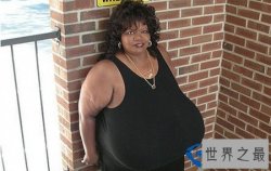 世界上最大的乳房：双胸重达38.5公斤